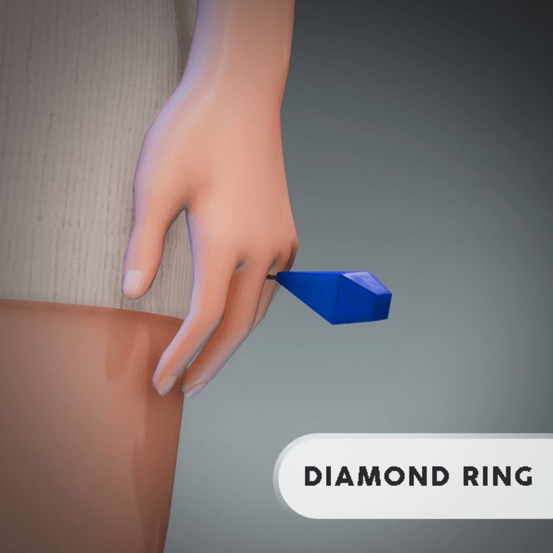 Blue Diamond Ring