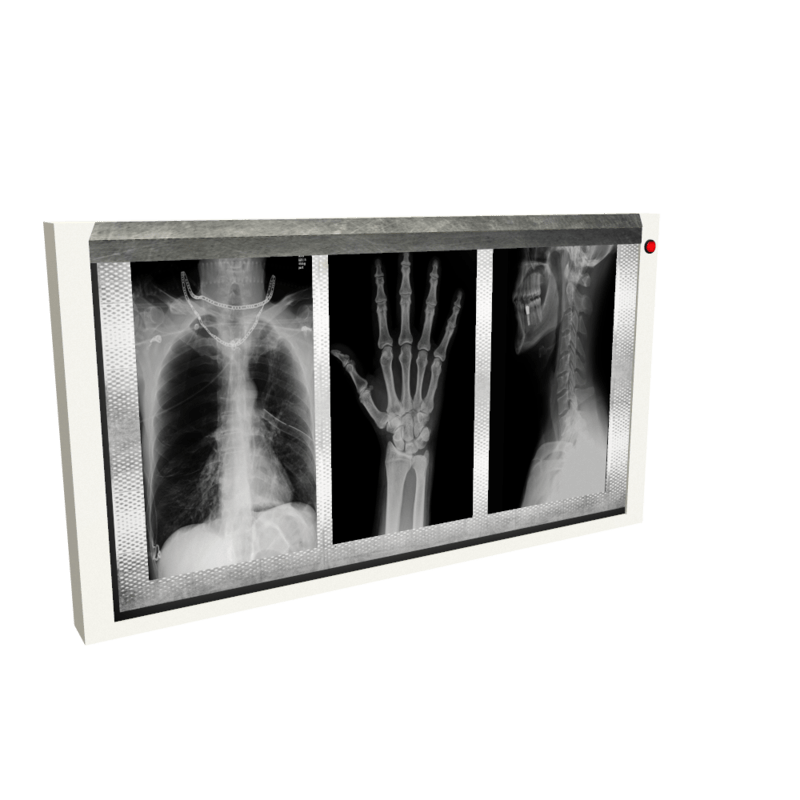 Xray Viewer